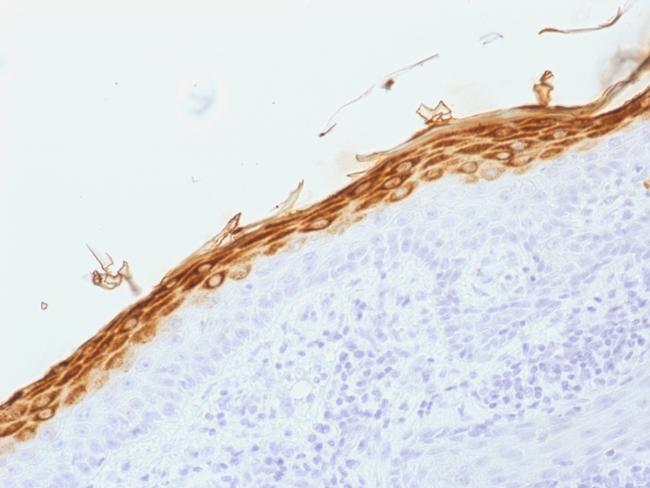 Filaggrin (Keratinocyte Differentiation Marker) Antibody in Immunohistochemistry (Paraffin) (IHC (P))