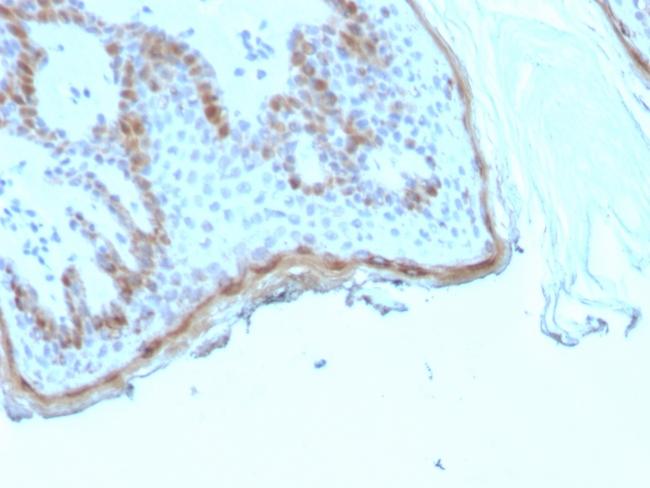 Filaggrin (Keratinocyte Differentiation Marker) Antibody in Immunohistochemistry (Paraffin) (IHC (P))