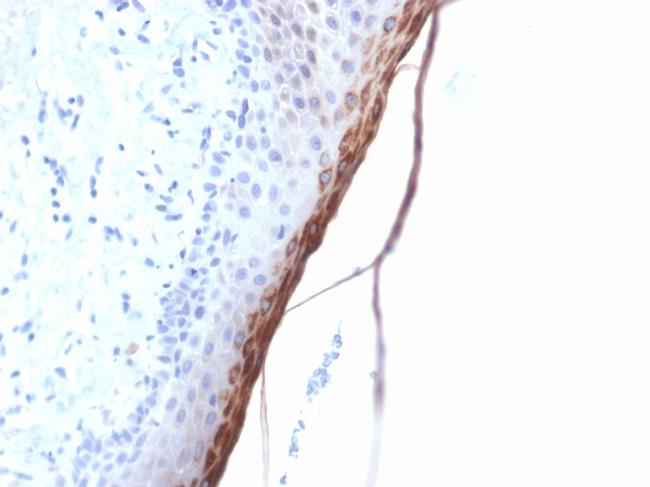 Filaggrin Antibody in Immunohistochemistry (Paraffin) (IHC (P))