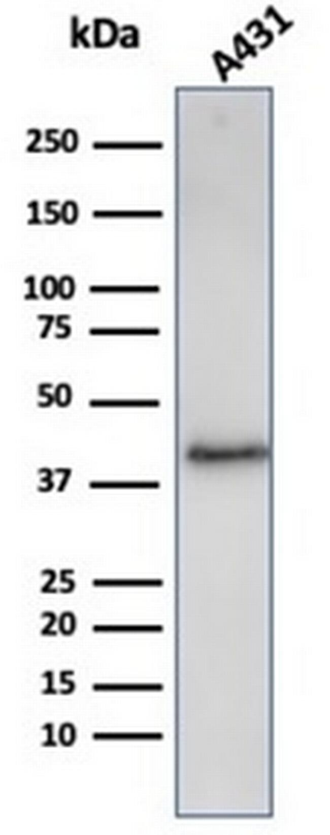 Filaggrin (Keratinocyte Differentiation Marker) Antibody in Western Blot (WB)