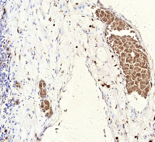 FLI1 (Ewing's Sarcoma and Endothelial Marker) Antibody in Immunohistochemistry (Paraffin) (IHC (P))