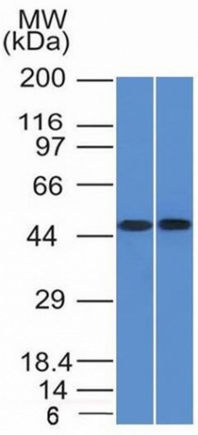 FLI1 (Ewing's Sarcoma and Endothelial Marker) Antibody in Western Blot (WB)