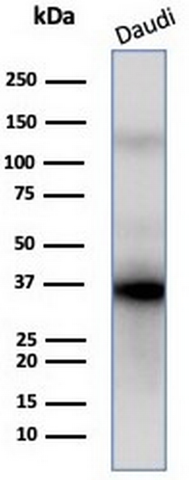 FLI1 (Ewing's Sarcoma and Endothelial Marker) Antibody in Western Blot (WB)