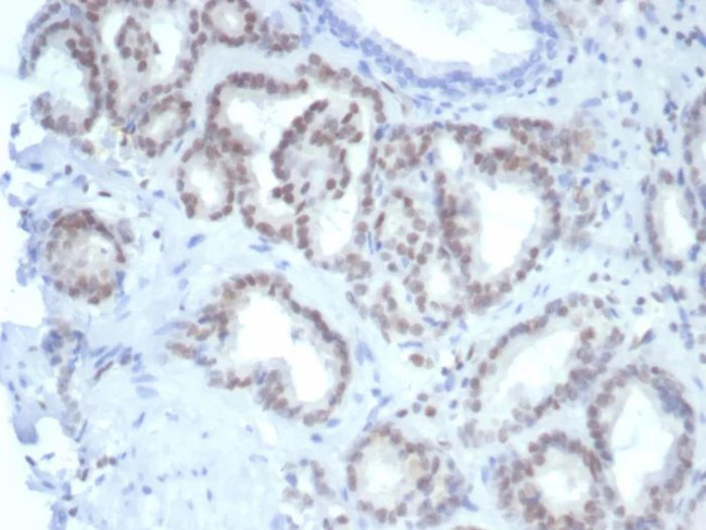 FLI1 (Ewing's Sarcoma and Endothelial Marker) Antibody in Immunohistochemistry (Paraffin) (IHC (P))