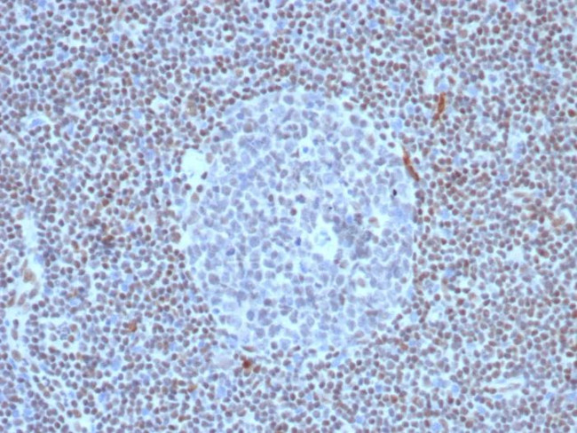 FLI1 (Ewing's Sarcoma and Endothelial Marker) Antibody in Immunohistochemistry (Paraffin) (IHC (P))