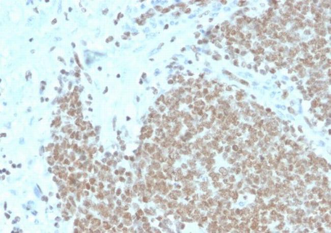 FLI1 (Ewing's Sarcoma and Endothelial Marker) Antibody in Immunohistochemistry (Paraffin) (IHC (P))