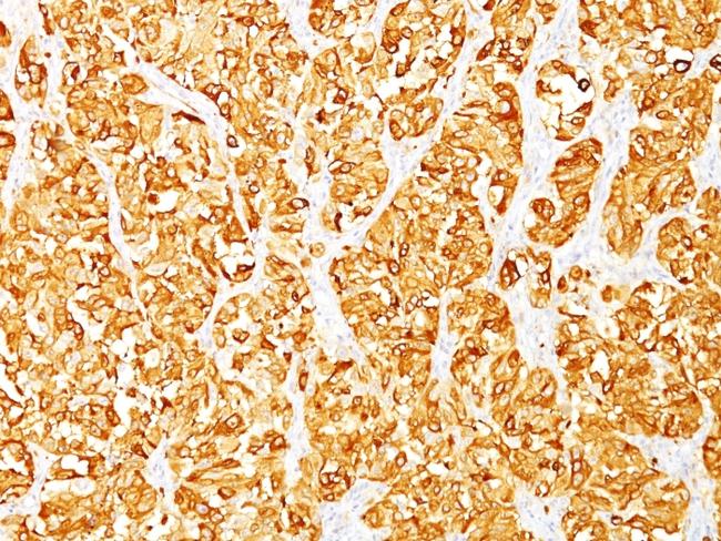 MART-1/Melan-A/MLANA (Melanoma Marker) Antibody in Immunohistochemistry (Paraffin) (IHC (P))