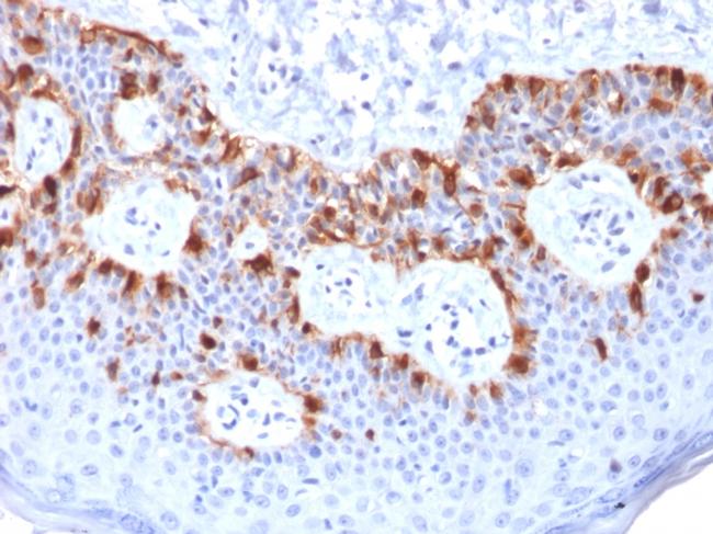 MART-1/Melan-A/MLANA Antibody in Immunohistochemistry (Paraffin) (IHC (P))