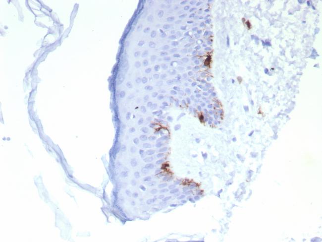 MART-1/Melan-A/MLANA (Melanoma Marker) Antibody in Immunohistochemistry (Paraffin) (IHC (P))