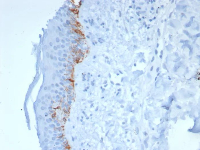 MART-1/Melan-A/MLANA (Melanoma Marker) Antibody in Immunohistochemistry (Paraffin) (IHC (P))