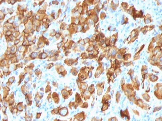 MART-1/Melan-A/MLANA (Melanoma Marker) Antibody in Immunohistochemistry (Paraffin) (IHC (P))