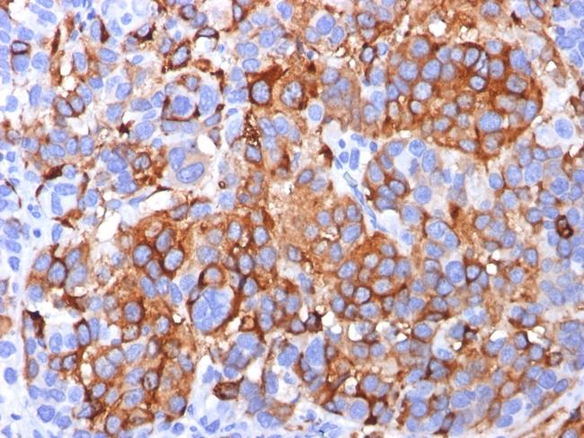 MART-1/Melan-A/MLANA (Melanoma Marker) Antibody in Immunohistochemistry (Paraffin) (IHC (P))