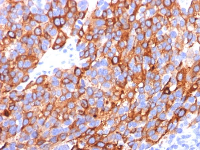 MART-1/Melan-A/MLANA (Melanoma Marker) Antibody in Immunohistochemistry (Paraffin) (IHC (P))