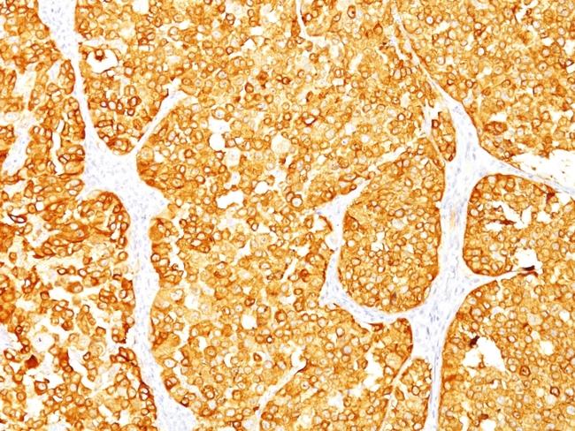 MART-1/Melan-A/MLANA (Melanoma Marker) Antibody in Immunohistochemistry (Paraffin) (IHC (P))