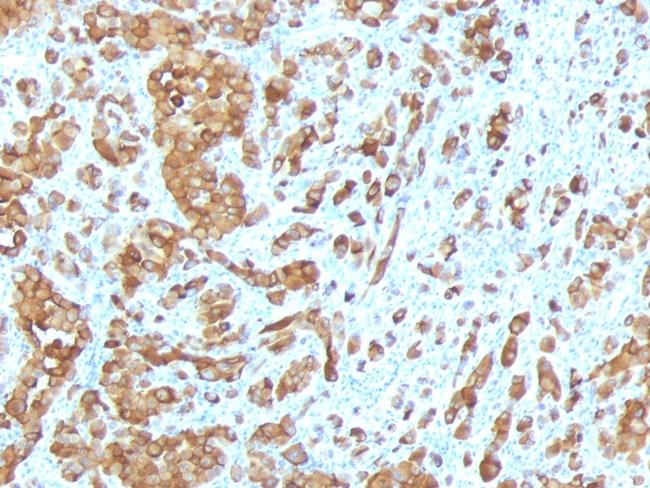 MART-1/Melan-A/MLANA (Melanoma Marker) Antibody in Immunohistochemistry (Paraffin) (IHC (P))