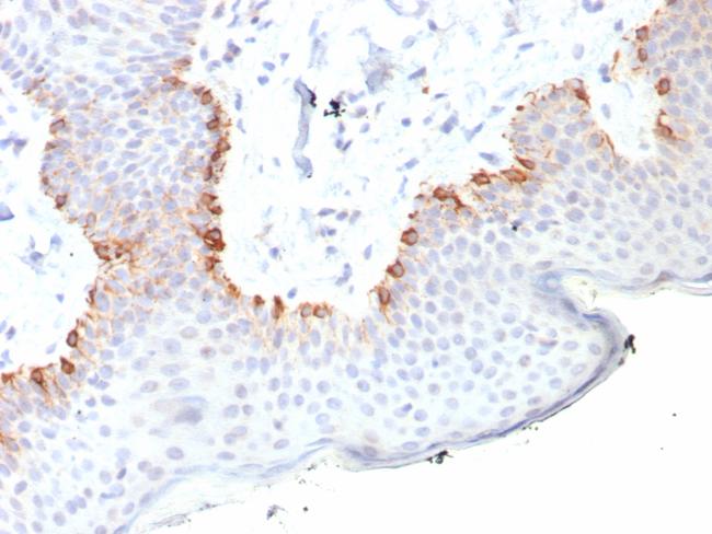 MART-1/Melan-A/MLANA (Melanoma Marker) Antibody in Immunohistochemistry (Paraffin) (IHC (P))