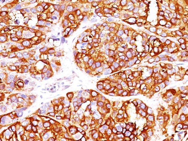 MART-1/Melan-A/MLANA Antibody in Immunohistochemistry (Paraffin) (IHC (P))