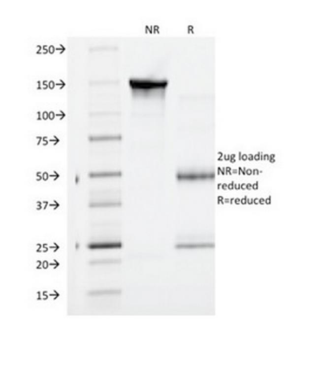 VEGF-R1/FLT-1 Antibody in SDS-PAGE (SDS-PAGE)