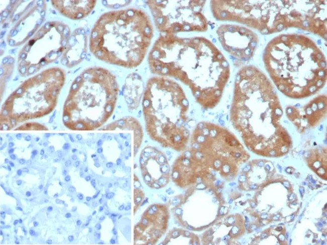 DBC2/RHOBTB2 Antibody in Immunohistochemistry (Paraffin) (IHC (P))