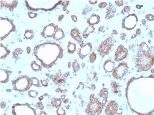 DBC2/RHOBTB2 Antibody in Immunohistochemistry (Paraffin) (IHC (P))