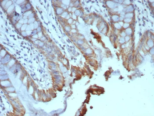 ICOS-L/ICOS Ligand/B7RP-1 (Immuno-Oncology Target) Antibody in Immunohistochemistry (Paraffin) (IHC (P))