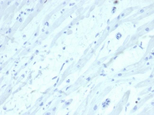 SATB2 (Colorectal Carcinoma Marker) Antibody in Immunohistochemistry (Paraffin) (IHC (P))