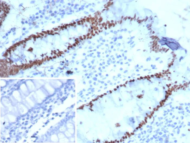 SATB2 (Colorectal Carcinoma Marker) Antibody in Immunohistochemistry (Paraffin) (IHC (P))