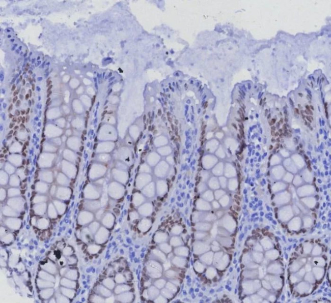 SATB2 (Colorectal Carcinoma Marker) Antibody in Immunohistochemistry (Paraffin) (IHC (P))