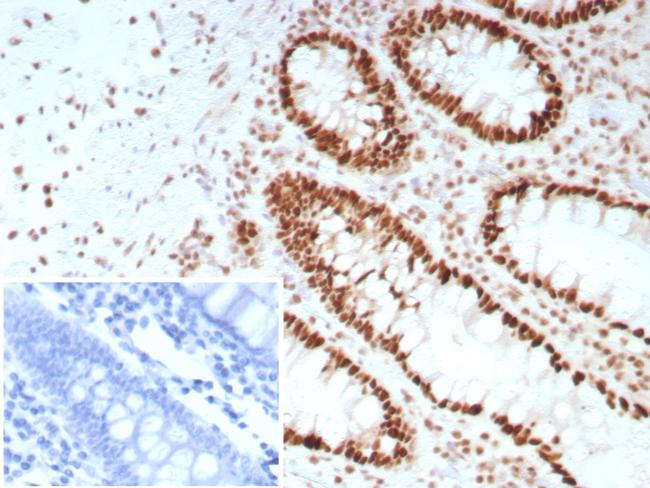 SATB2 (Colorectal Carcinoma Marker) Antibody in Immunohistochemistry (Paraffin) (IHC (P))