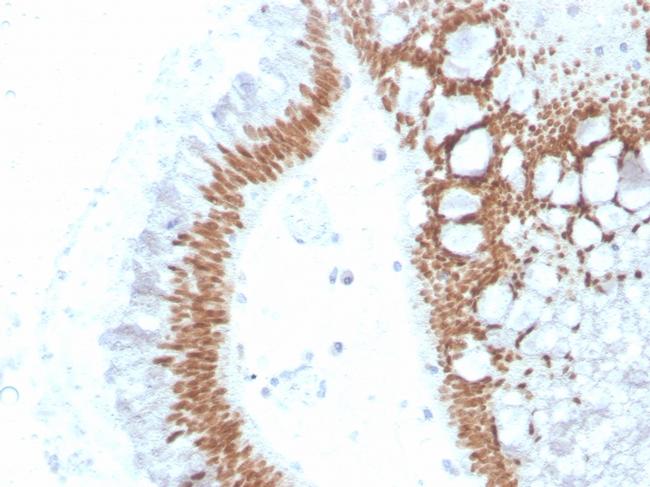 SATB2 Antibody in Immunohistochemistry (Paraffin) (IHC (P))