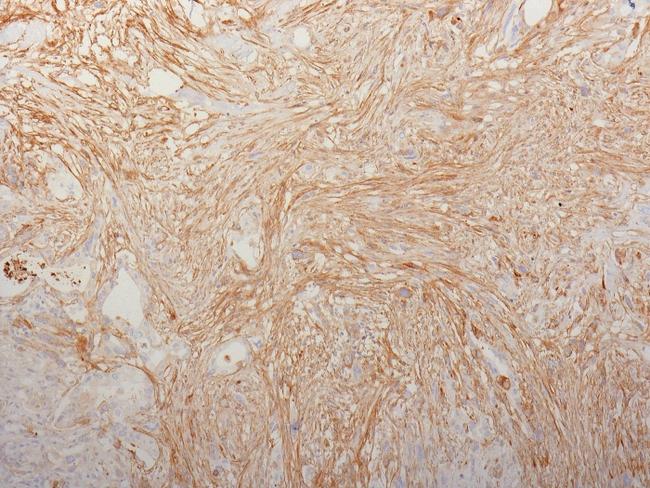 Fibronectin (Cellular and Plasma) Antibody in Immunohistochemistry (Paraffin) (IHC (P))