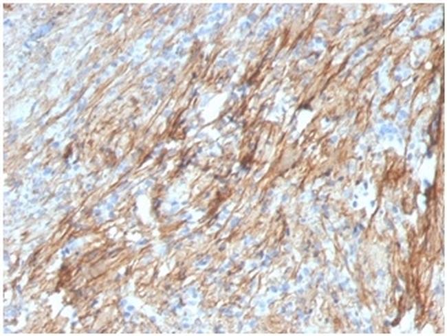 Fibronectin Antibody in Immunohistochemistry (Paraffin) (IHC (P))