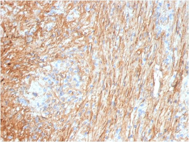 Fibronectin Antibody in Immunohistochemistry (Paraffin) (IHC (P))