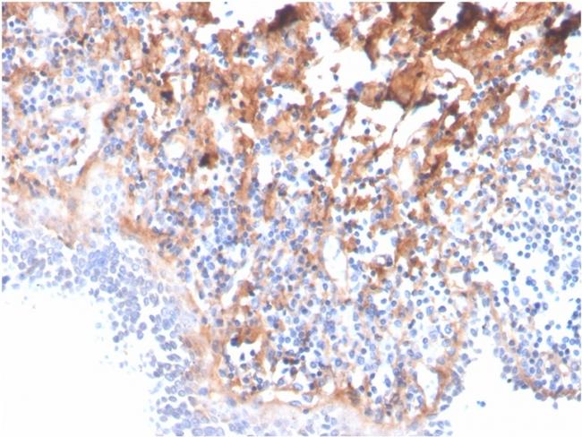 Fibronectin (Total) Antibody in Immunohistochemistry (Paraffin) (IHC (P))