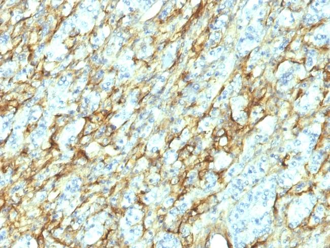 Fibronectin (8th Type III Repeat) Antibody in Immunohistochemistry (Paraffin) (IHC (P))