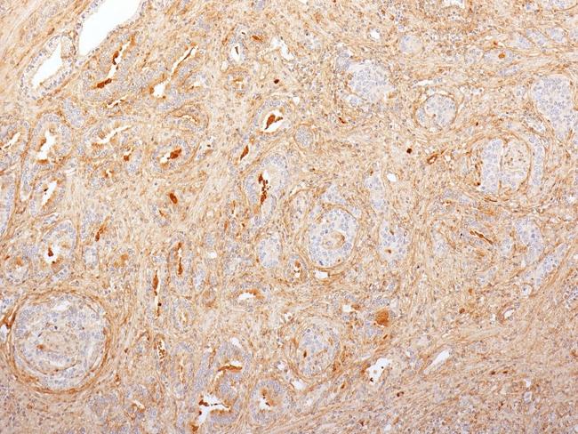 Fibronectin (Fibrin/Heparin-Binding Domain) Antibody in Immunohistochemistry (Paraffin) (IHC (P))