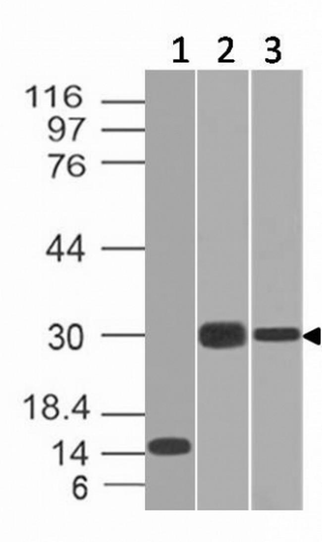 CELA3B/ELA3B (Pancreatic Function Marker) Antibody in Western Blot (WB)