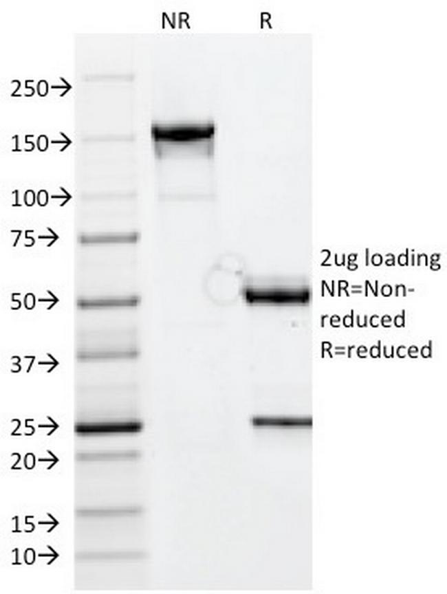 CELA3B/ELA3B (Pancreatic Function Marker) Antibody in SDS-PAGE (SDS-PAGE)