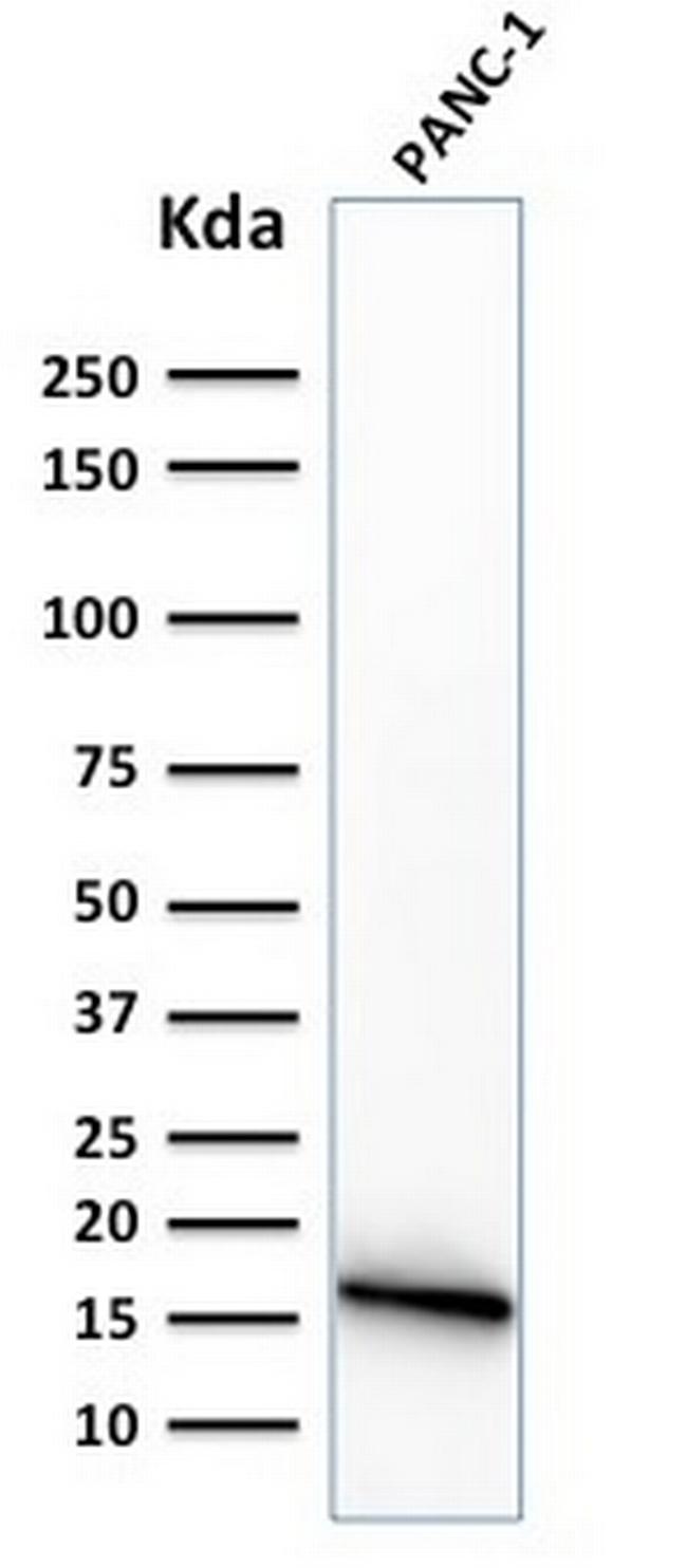 CELA3B/ELA3B (Pancreatic Function Marker) Antibody in Western Blot (WB)