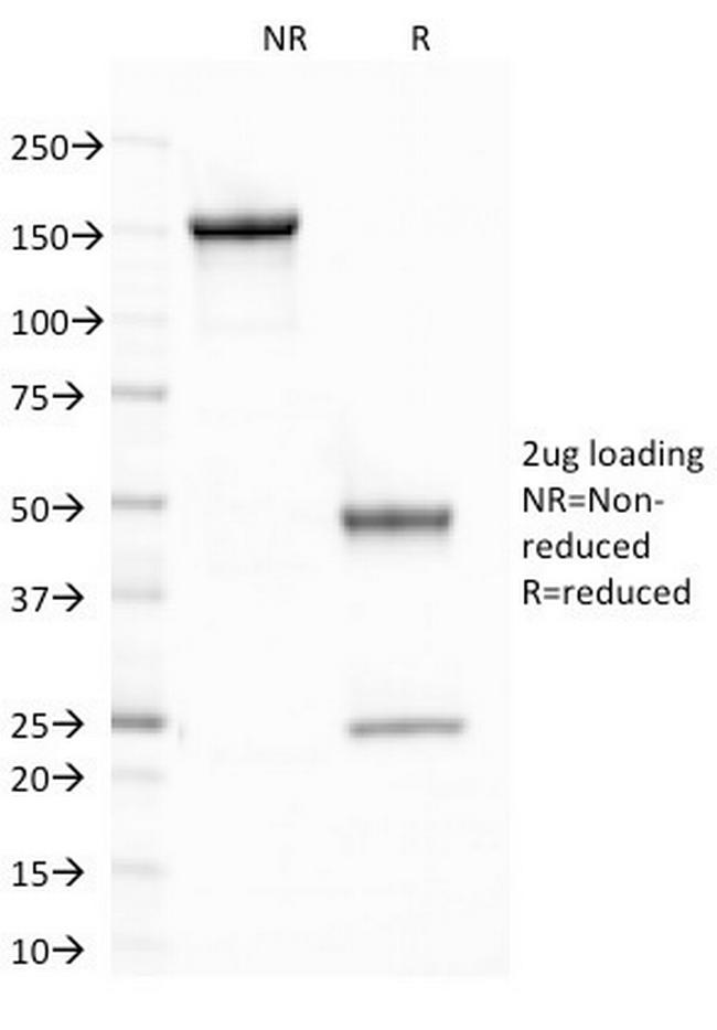 CELA3B/ELA3B (Pancreatic Function Marker) Antibody in SDS-PAGE (SDS-PAGE)