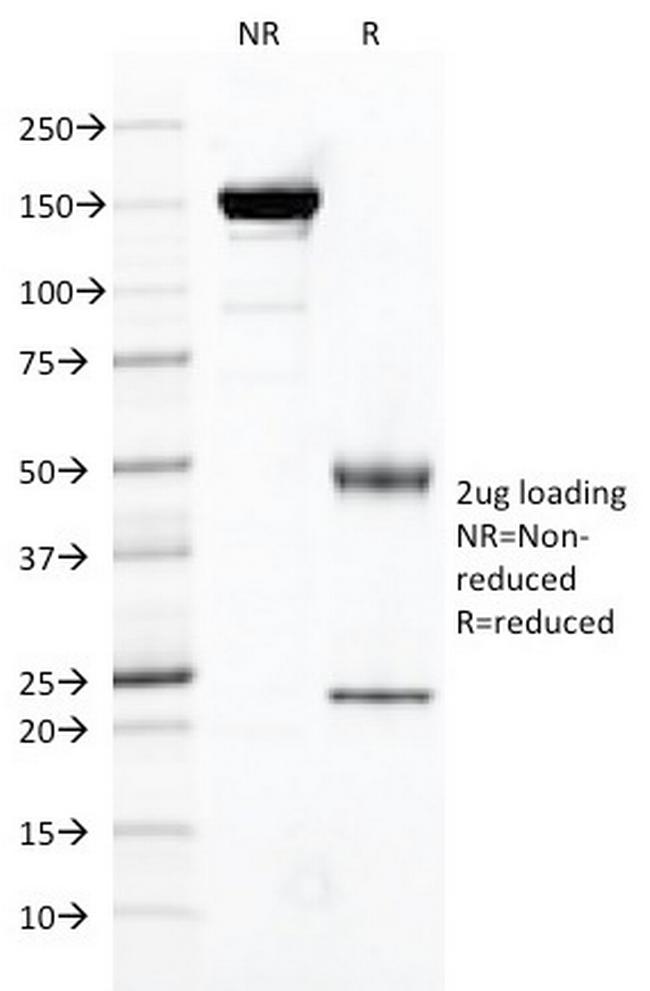 FOLH1/PSMA (Prostate Epithelial Marker) Antibody in SDS-PAGE (SDS-PAGE)