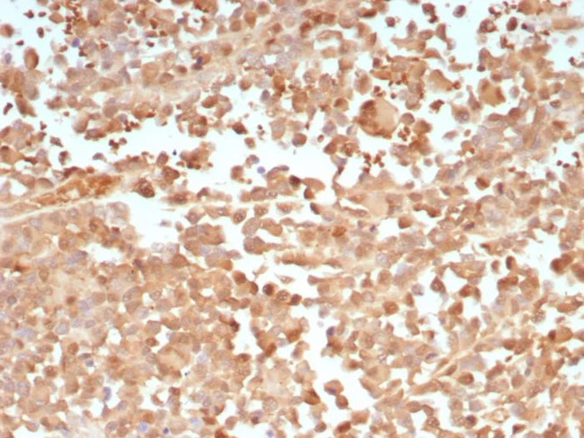 PRAME nuclear receptor transcriptional regulator Antibody in Immunohistochemistry (Paraffin) (IHC (P))