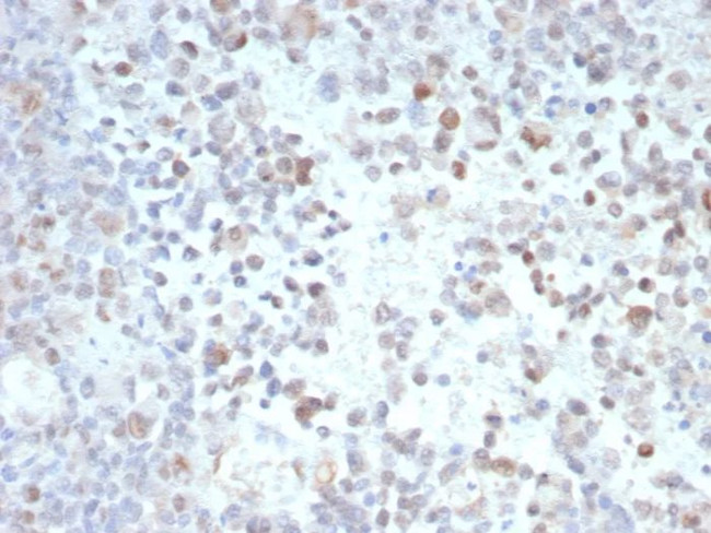 PRAME nuclear receptor transcriptional regulator Antibody in Immunohistochemistry (Paraffin) (IHC (P))