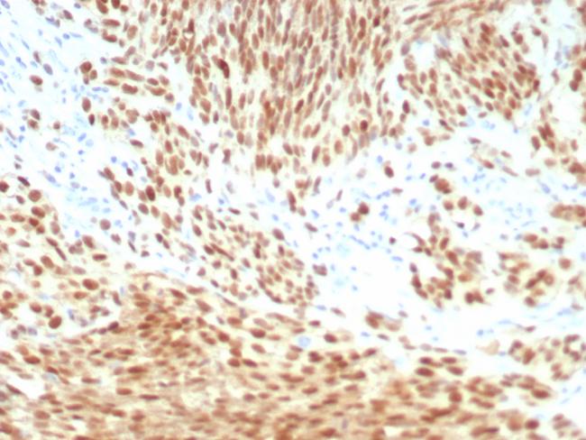 PRAME nuclear receptor transcriptional regulator Antibody in Immunohistochemistry (Paraffin) (IHC (P))