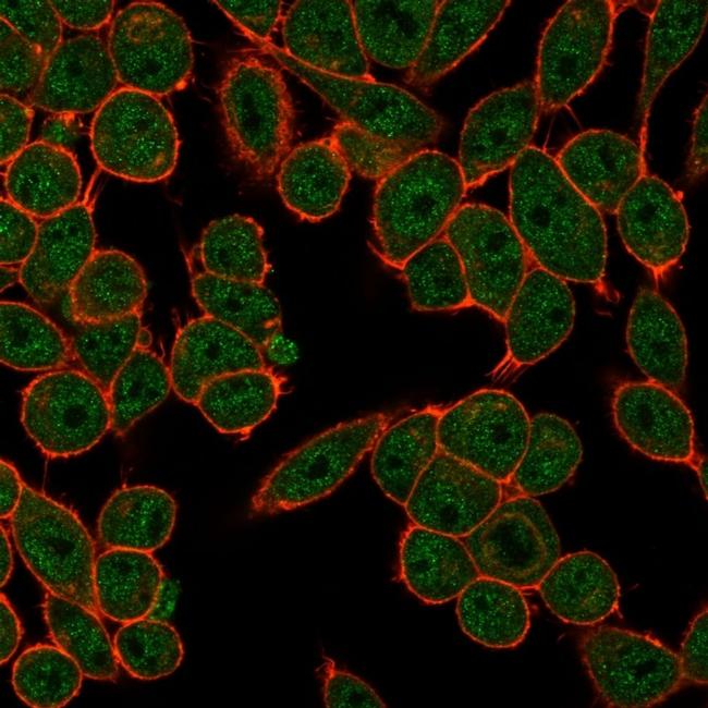 Fos-related antigen 2 (FRA-2)/FOS-like antigen 2 (FOSL2) Antibody in Immunocytochemistry (ICC/IF)