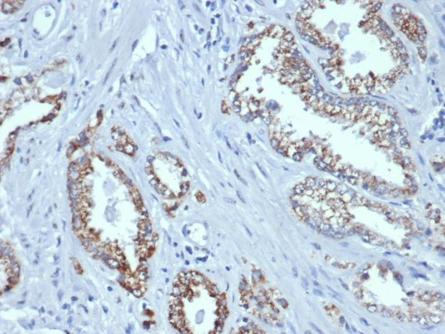 AMACR/p504S (Prostate Cancer Marker) Antibody in Immunohistochemistry (Paraffin) (IHC (P))