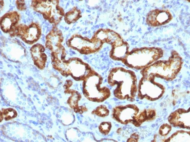 AMACR/p504S (Prostate Cancer Marker) Antibody in Immunohistochemistry (Paraffin) (IHC (P))