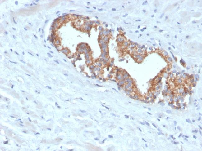 AMACR/p504S Antibody in Immunohistochemistry (Paraffin) (IHC (P))