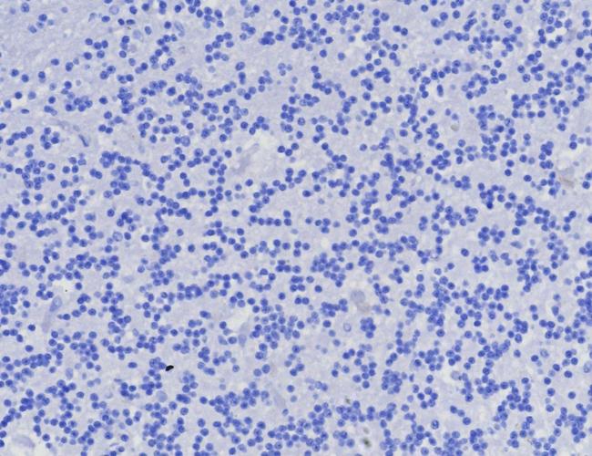 AMACR/p504S (Prostate Cancer Marker) Antibody in Immunohistochemistry (Paraffin) (IHC (P))