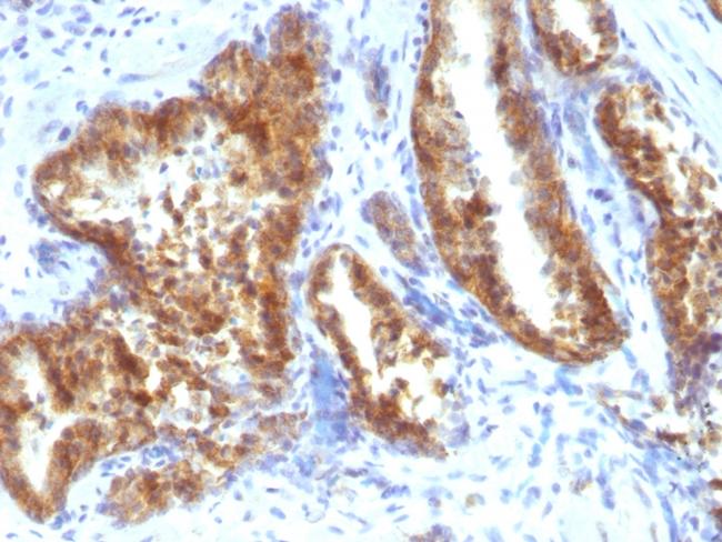 AMACR/p504S (Prostate Cancer Marker) Antibody in Immunohistochemistry (Paraffin) (IHC (P))